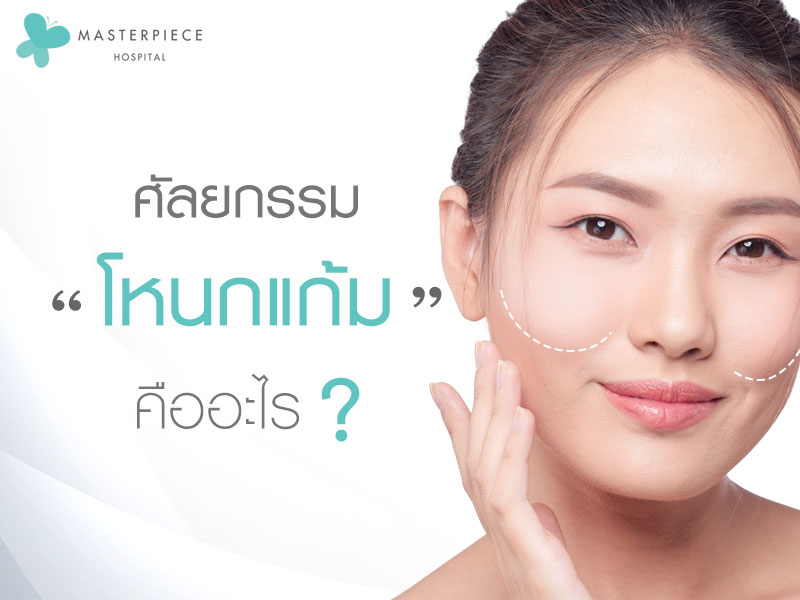 ศัลยกรรมโหนกแก้มคืออะไร